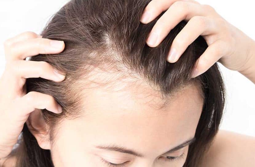 Is your thyroid disorders causing hair loss and thinning